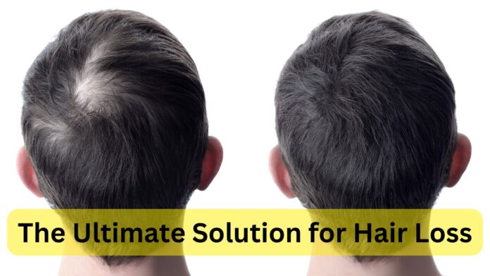 Alma TED - The ultimate solution for hair loss.